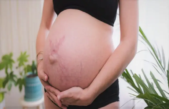 Postpartum Pregnancy
